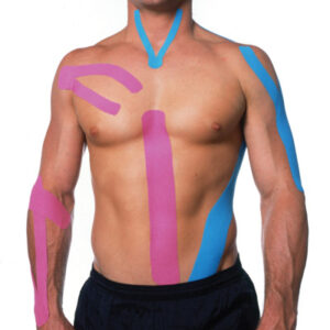 Kinesio-taping